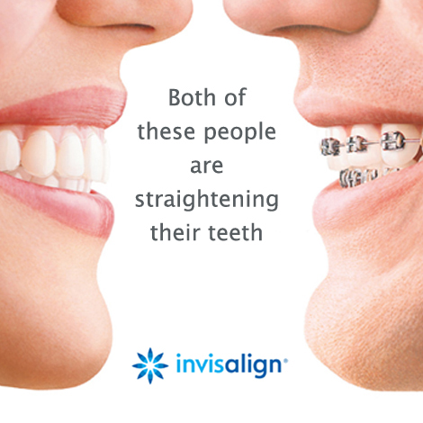 Invisalign Edmonton